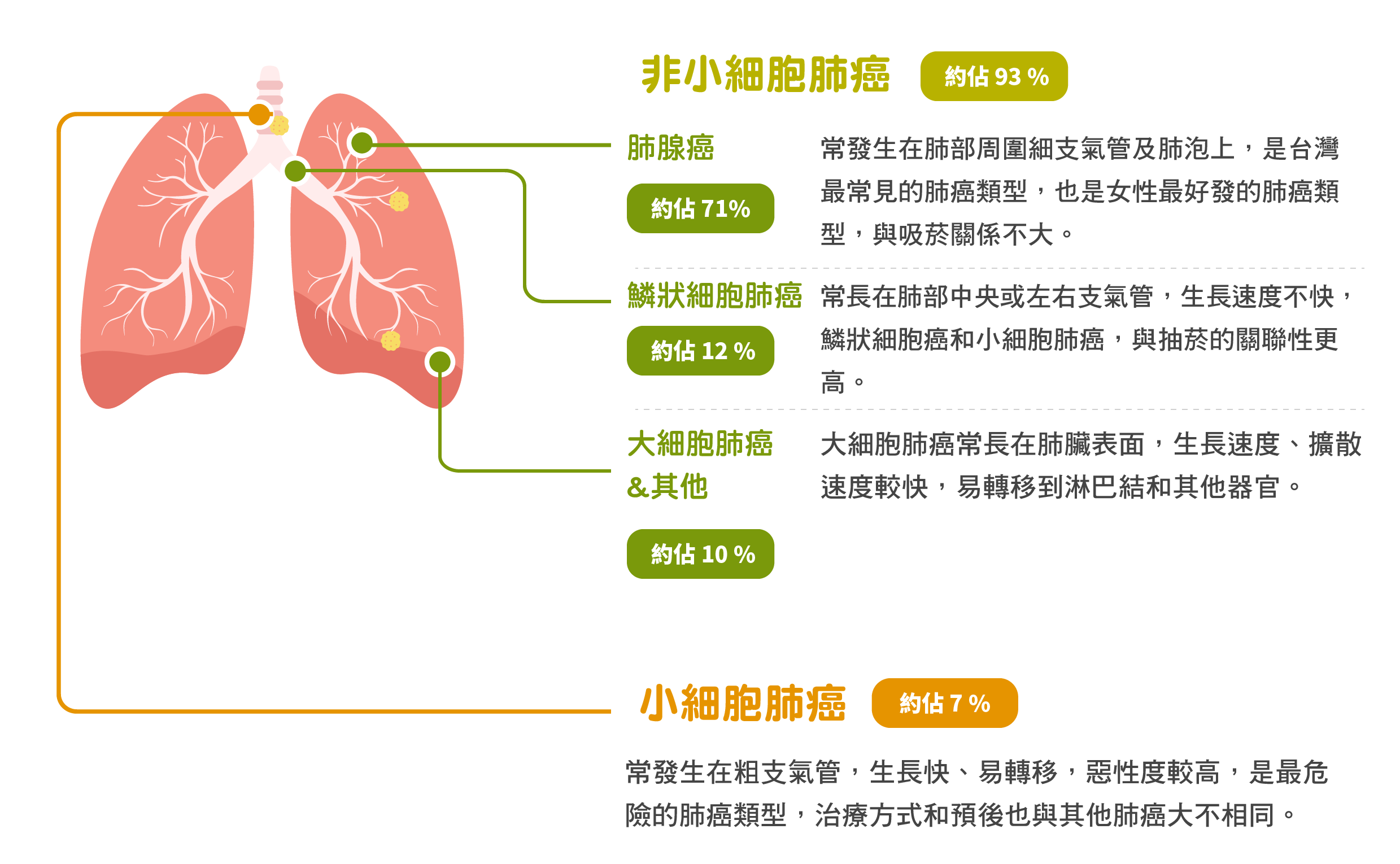二、肺癌分类-呼吸系统-医学