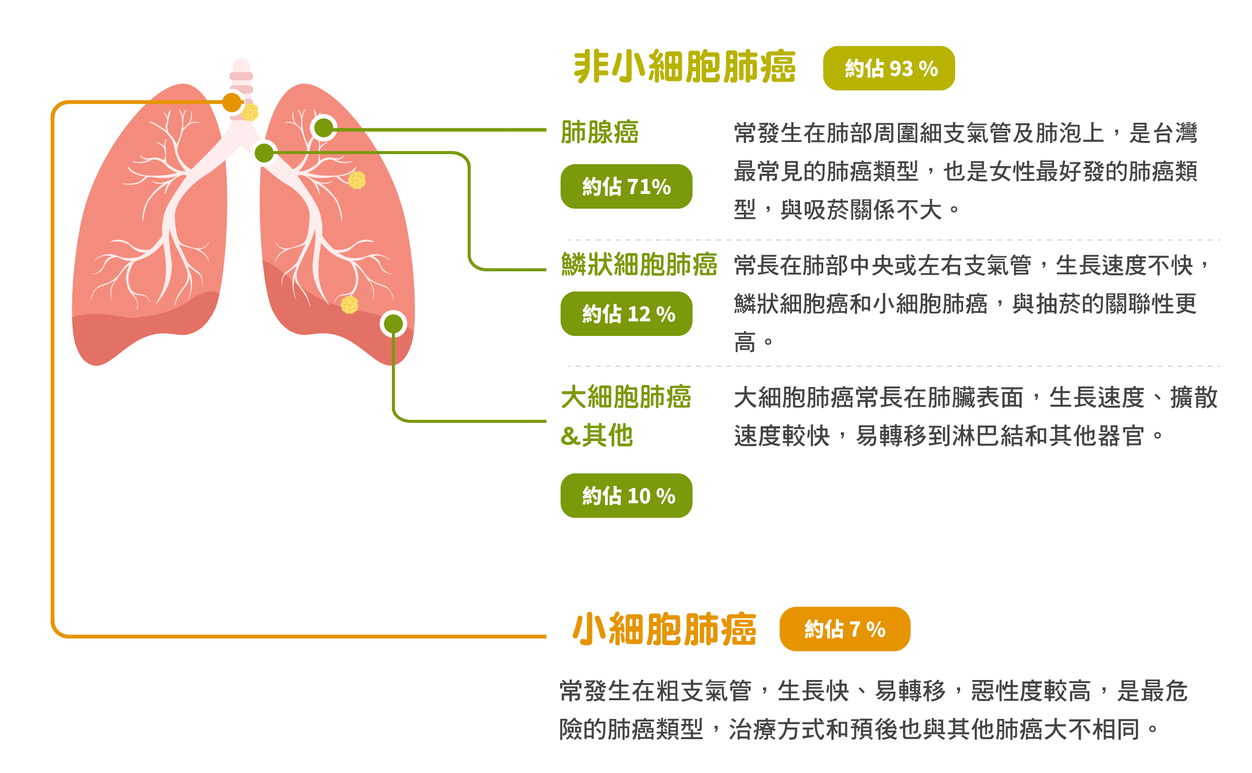 肺癌種類&發生位置說明